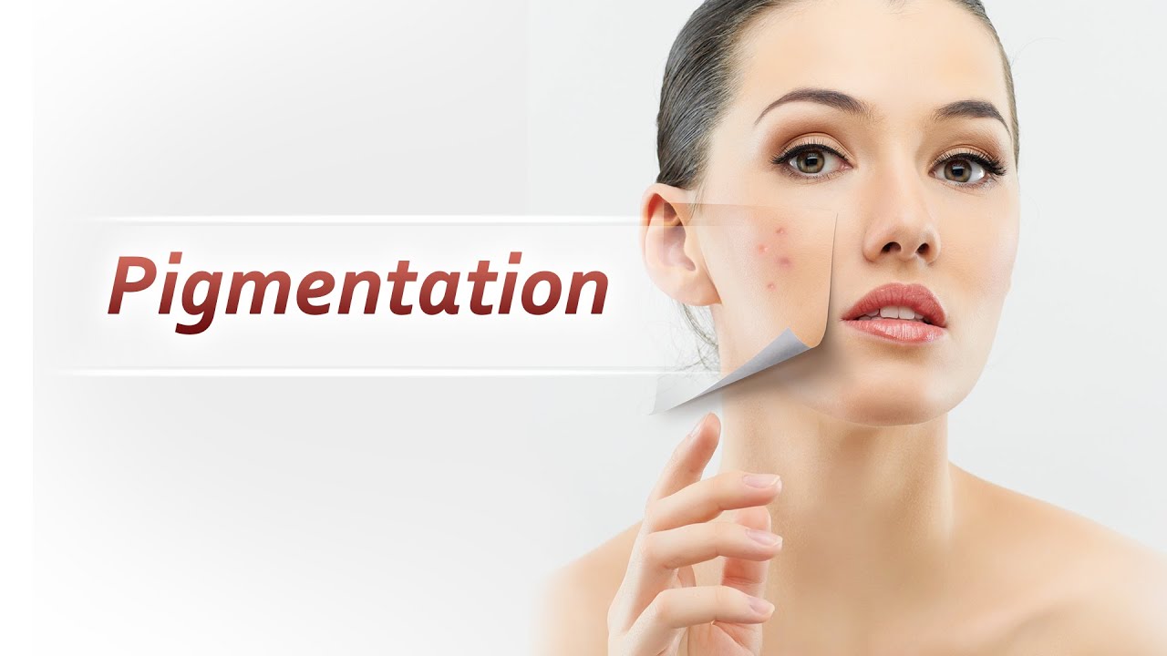 Best HyperPigmentation Skin Treatment in Delhi SKINVED CliniQ