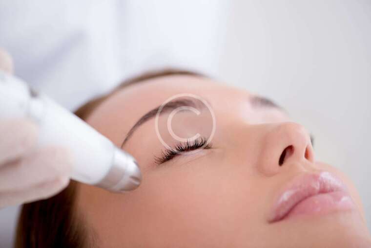 Laser Toning Treatment Delhi Dr. Mahima Wadhwa SKIN CliniQ